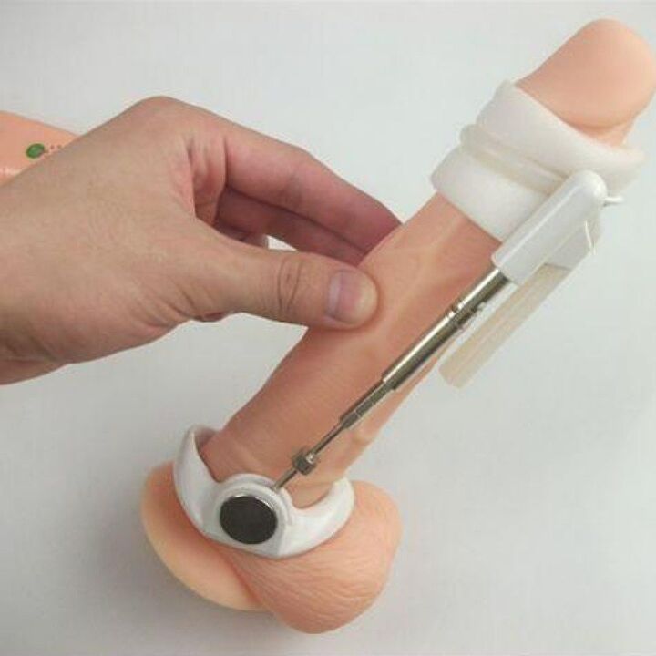 An extender will help increase the size of the penis without cream